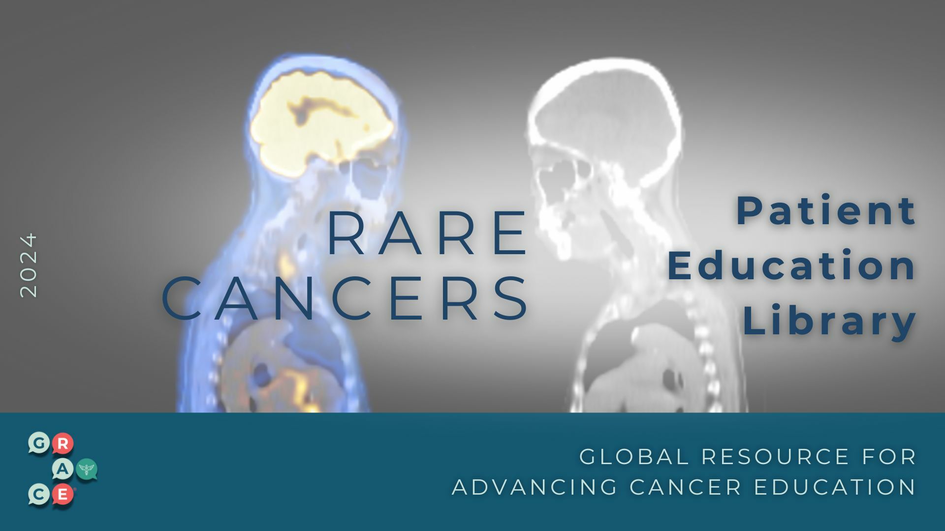 Rare cancers 